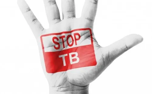TB testing in South Africa