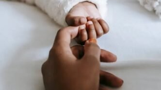 Conjoined twins in hospital