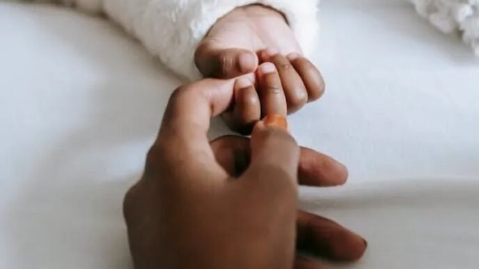 Conjoined twins in hospital