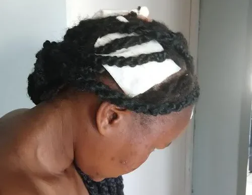 Umlazi woman seeking help after domestic violence incident